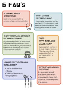 Erythroplakia FAQ's