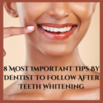 8 Most Important Tips to Maintain Your Bright Smile After Teeth Whitening