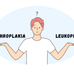Erythroplakia vs Leukoplakia