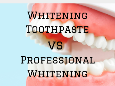 Professional whitening